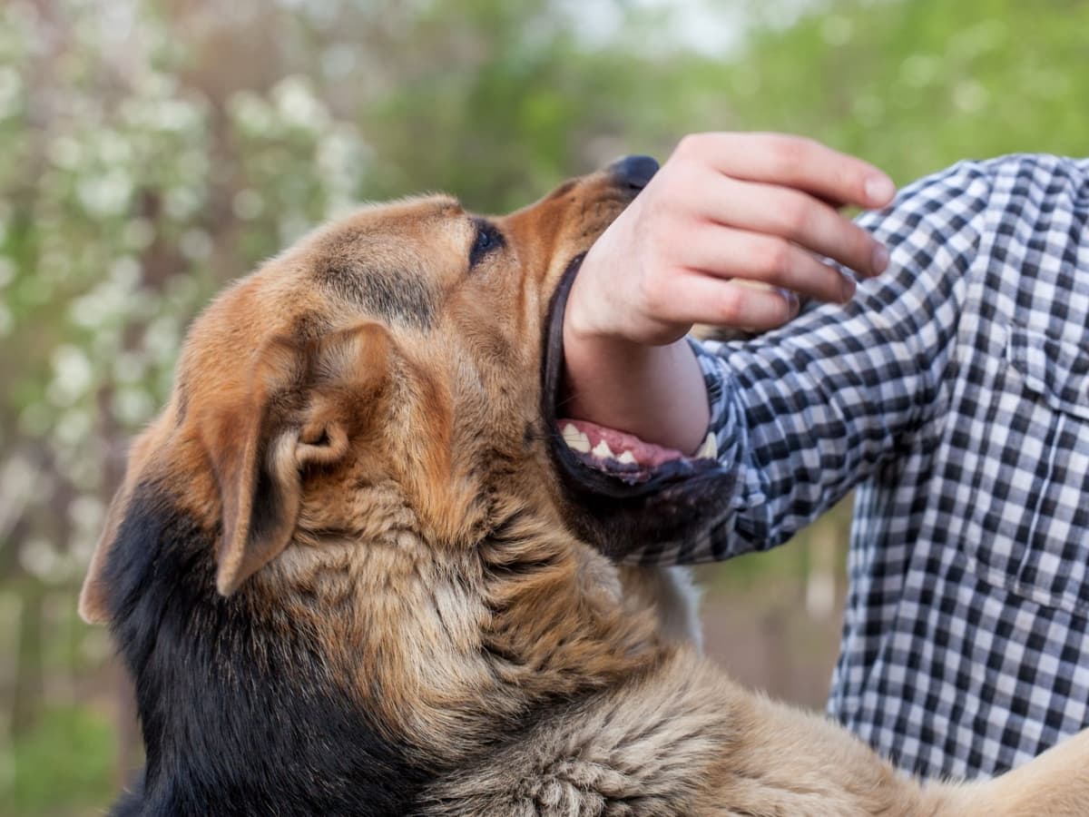 What To Do On Dog Bite: જો કૂતરુ કરડે તો પહેલા શું કરવું જોઈએ? એક્સપર્ટ પાસેથી જાણો ઉપચાર