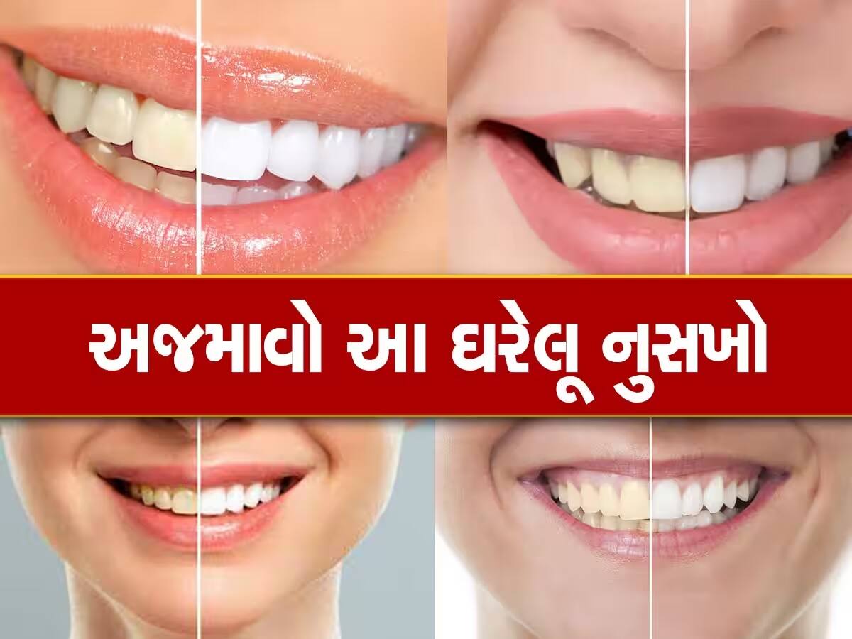 Teeth Cleaning: ડેન્ટિસ્ટનો ખર્ચ બચાવવા માંગો છો? તો આ 5 ટ્રિક્સથી દાંતની પીળાશ કરો દૂર