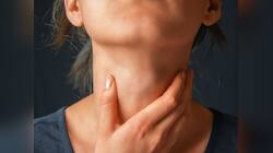 Thyroid થી બચવા માટે આ વસ્તુઓને ડાયેટમાં કરો સામેલ, ક્યારેય નહીં થાય કોઈ સમસ્યા