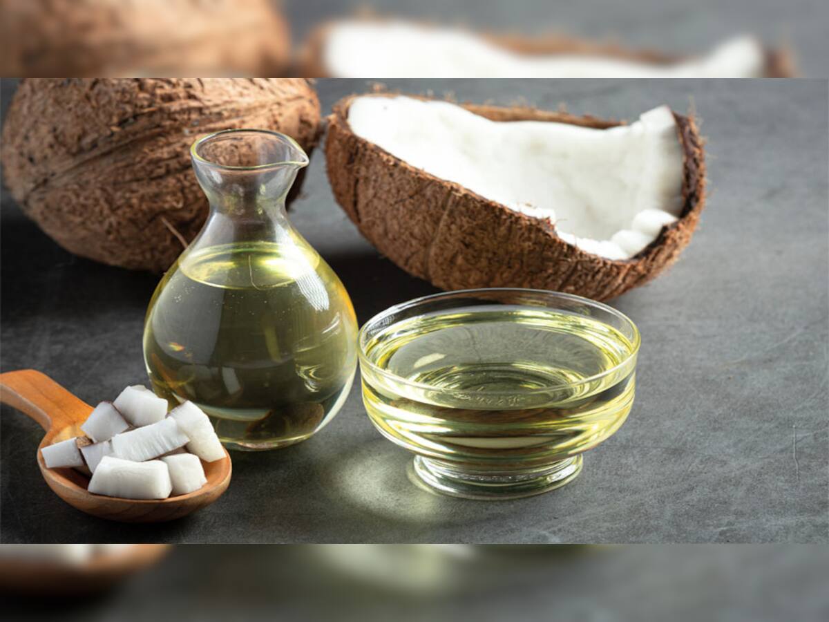 Coconut Oil Business: નાળિયેર તેલનો બિઝનેસ છે બેસ્ટ, ઓછા રોકાણમાં કરી શકો છો લાખોની કમાણી