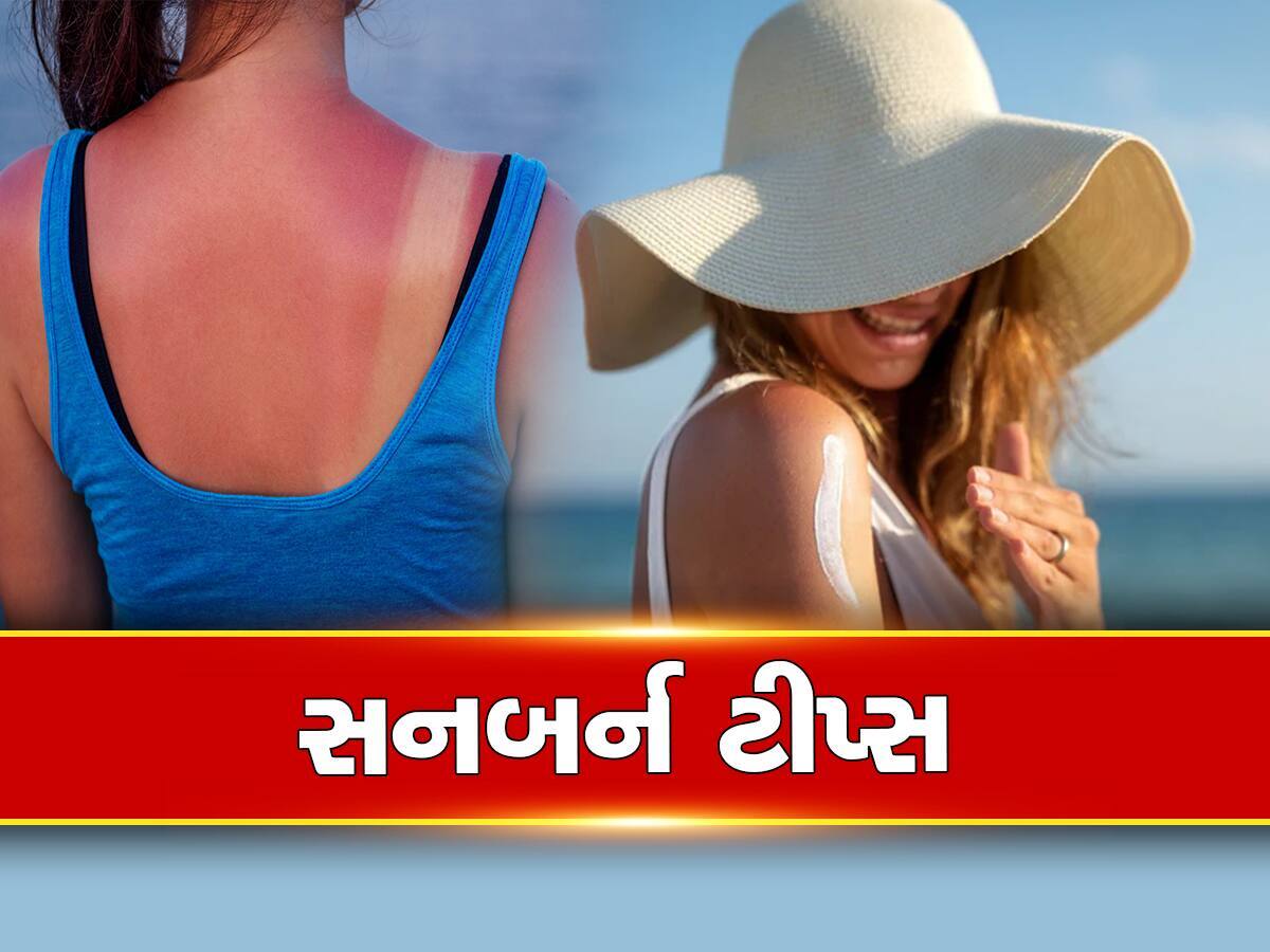 Natural sunscreen: સનબર્નથી બચવા ઘરમાં રહેલ આ 5 વસ્તુનો કરો ઉપયોગ, ત્વચા રહેશે ડેમેજ ફ્રી