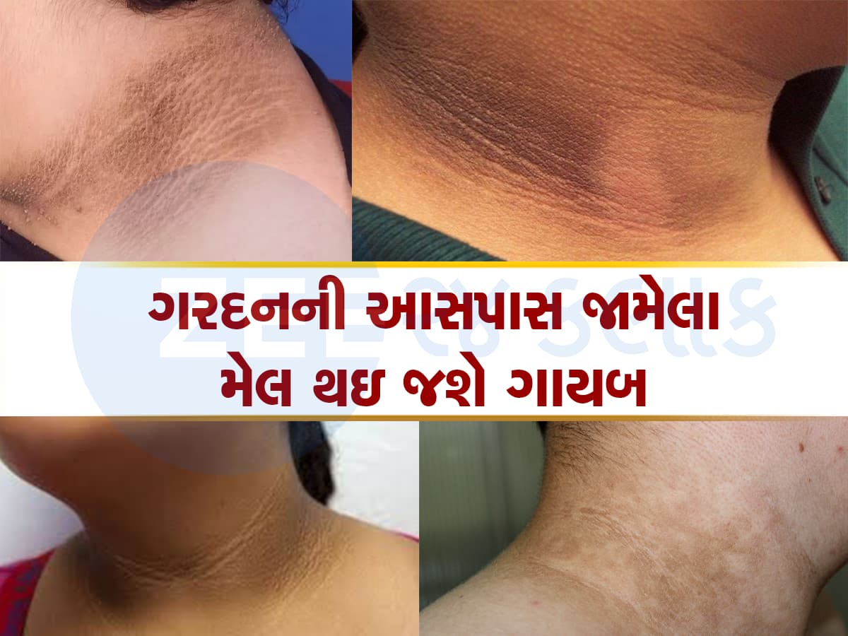 Black Neck Remedy: ફક્ત 15 મિનિટ સાફ થઇ જશે તમારી કાળી ગરદન, આ ઉપાયોથી મળશે જોરદાર રિઝલ્ટ