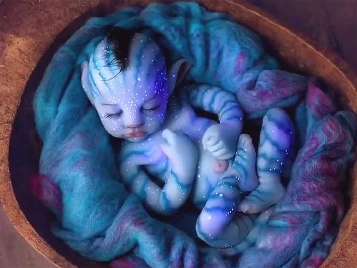 કરોડોમાં એક બનતો કિસ્સો : ગુજરાતી મહિલાના કૂખે અવતાર ફિલ્મ જેવુ વાદળી રંગનું બાળક જન્મ્યું 