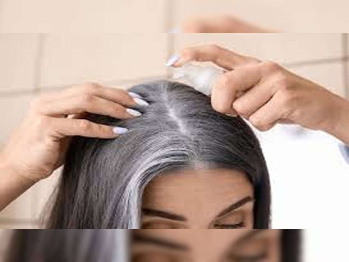 Hair Care: મૂળમાંથી સફેદ થયેલા વાળ પણ થવા લાગશે કાળા, અઠવાડિયામાં 3 દિવસ વાળમાં લગાડો આ રસ