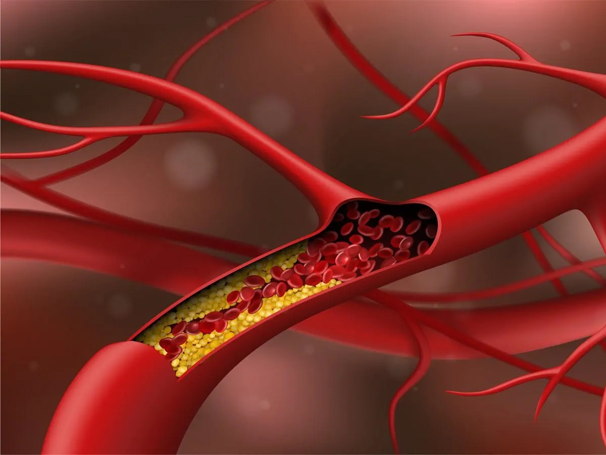 Bad Cholesterol ઓછું કરવા માટે ડાયેટમાં સામેલ કરો 2 વસ્તુઓ, હાઇ કોલેસ્ટ્રોલની સમસ્યા થશે દૂર઼