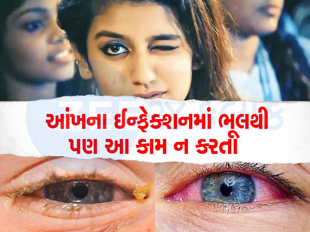 આંખમાં ઈન્ફેક્શન થાય તો સિંદૂર લગાવવાના અખતરા ન કરતા, આટલી બાબતોનું ખાસ ધ્યાન રાખો