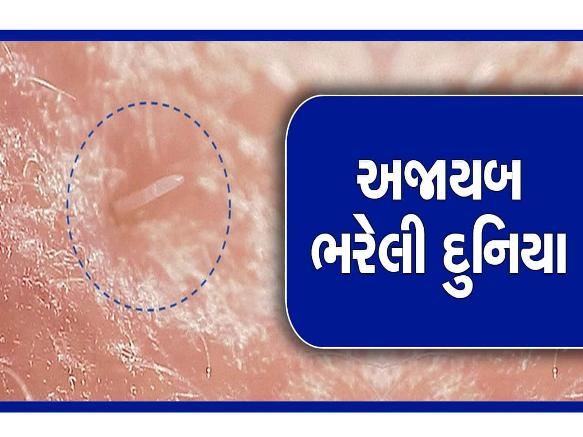 માણસોના સૂઈ ગયા બાદ માણસના ચહેરા પર સંભોગ કરે છે આ કીડા, કરી શકે છે તમને બિમાર