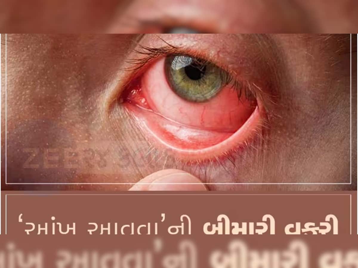 સાચવજો...ગુજરાતમાં વધી રહ્યો છે આંખનો રોગ, સૌરાષ્ટ્રની સૌથી મોટી સરકારી હોસ્પિટલ દર્દીઓથી ઉભરાઈ