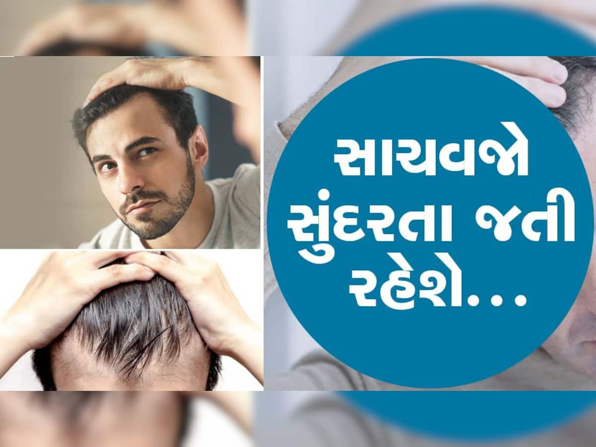 30 દિવસમાં ટાલમાં પણ દેખાવા લાગશે વાળ, ટ્રાય કરો આમાંથી કોઈપણ એક દેશી ઉપાય