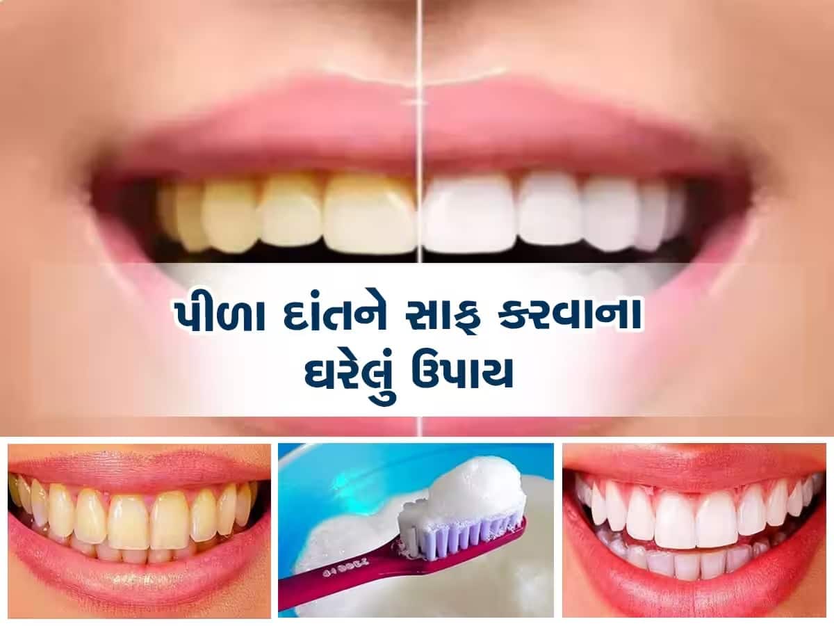 Teeth Whitening: પીળા દાંત સફેદ કરવાના 3 ઘરગથ્થુ ઉપાય, બસ આટલું કરવાથી મોતીની જેમ ચમકવા લાગશે 
