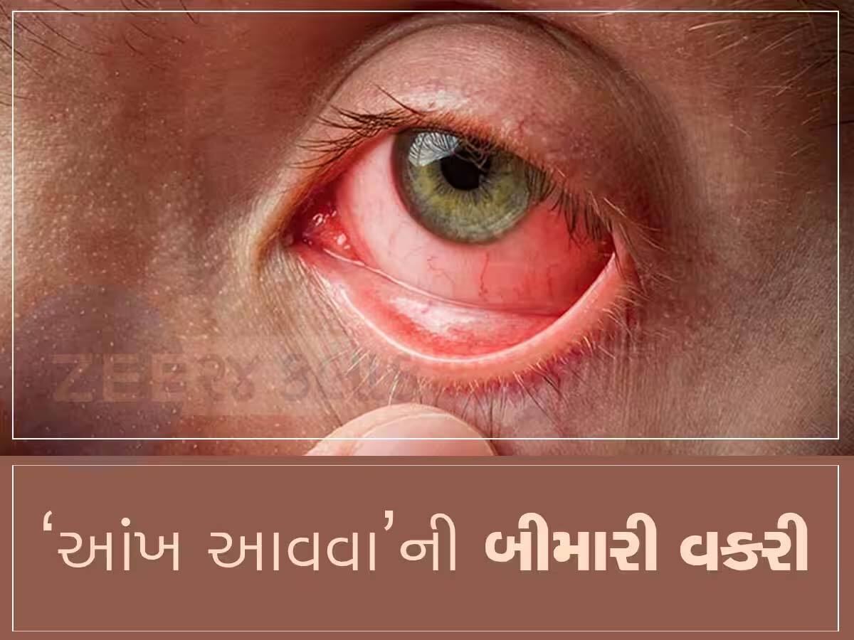 કોરોનાની જેમ આખું ગુજરાત ભરડામાં આવશે! રોજ આવી રહ્યાં છે 30 હજાર કેસ, જાણો શું કહે છે નિષ્ણાતો?