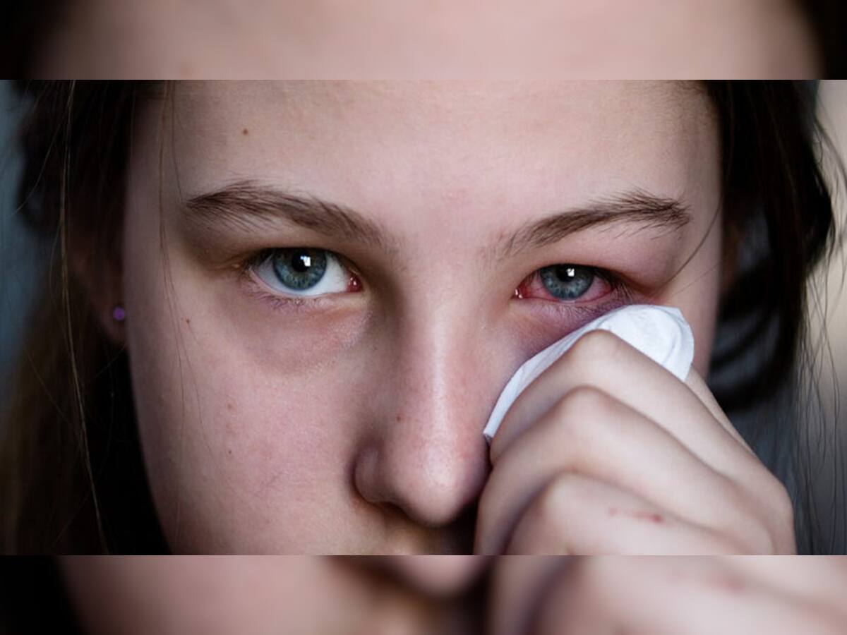 આંખની આ 5 બીમારીઓના કારણે આવી શકે છે અંધાપો, લક્ષણ દેખાય એટલે તુરંત કરાવો સારવાર