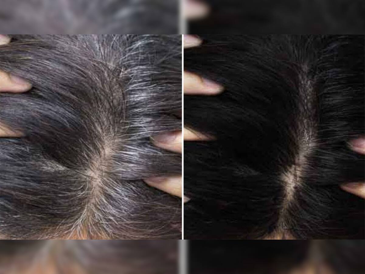 Hair Care: આ નેચરલ વસ્તુઓના ઉપયોગથી સફેદ વાળ 30 મિનિટમાં થઈ જશે કાળા, નહીં થાય કોઈ આડઅસર