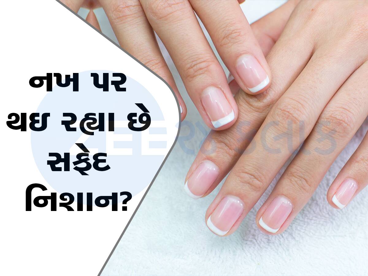 health Tips: નખ ખોલશે તમારા સ્વાસ્થ્યનું રહસ્ય, નખ પર આવા નિશાન દેખાય તો ચેતી જજો