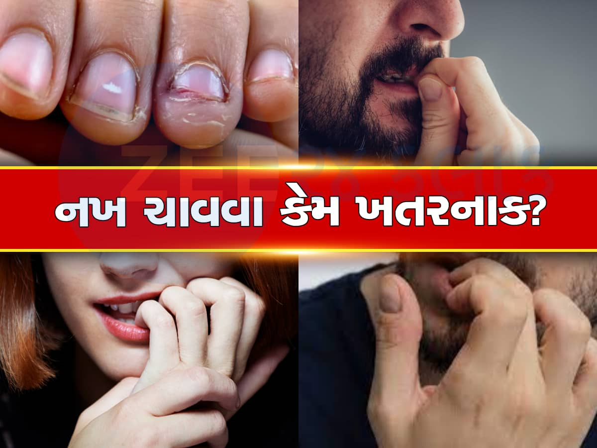 નખ ચાવવાની Bad Habit હોય તો સુધારી દેજો, નહીંતર થશે આ નુકસાન