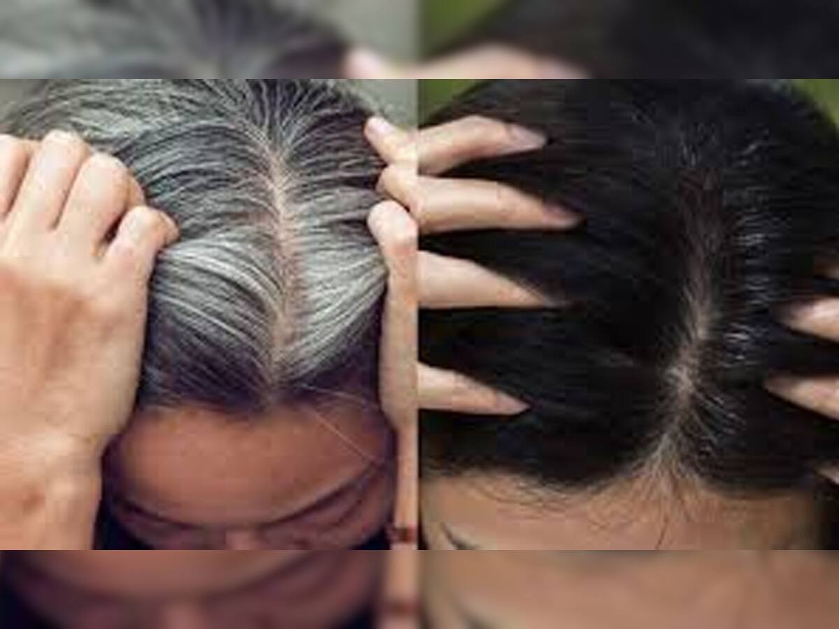 White Hair Solution: રોજની ડાયટમાં આ વસ્તુઓનો કરશો સમાવેશ તો અટકી જશે સફેદ વાળનો ગ્રોથ