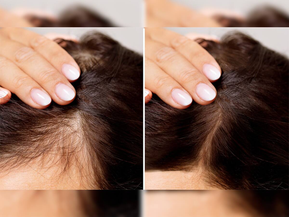 Tulsi Benefits: ખરતા વાળની સમસ્યા દુર કરશે તુલસીના પાન, જાણો ઉપયોગ કરવાની સાચી રીત