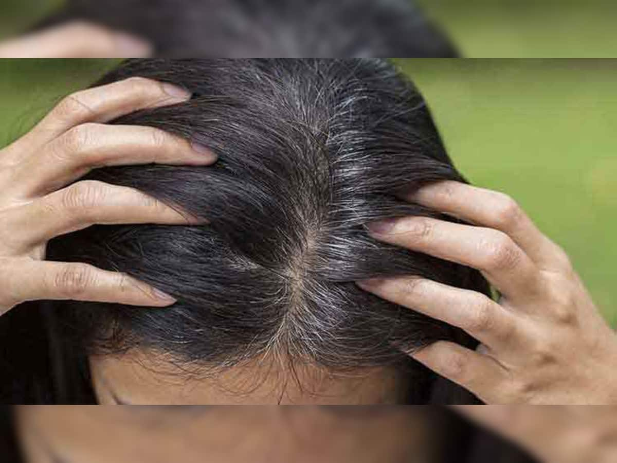 White Hair Solution: જો કરશો આ કામ તો માથામાં વધશે કાળા વાળ, નહીં દેખાય એક પણ સફેદ વાળ