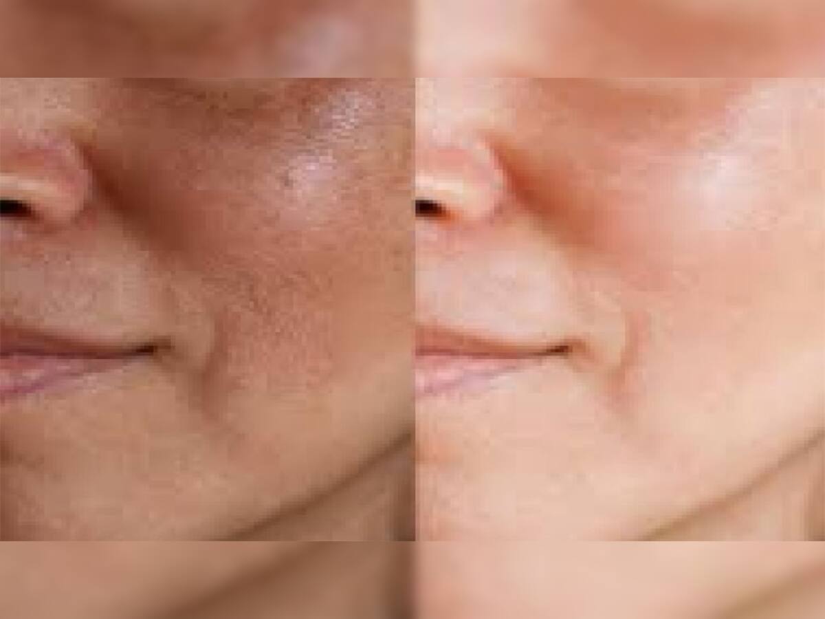 Skin Care: ચહેરા પર વધી ગઈ હોય ડેડ સ્કીન તો આ રીતે કરો લીંબુ અને મીઠાનો ઉપયોગ, 10 મિનિટમાં ચમકી જશે ત્વચા