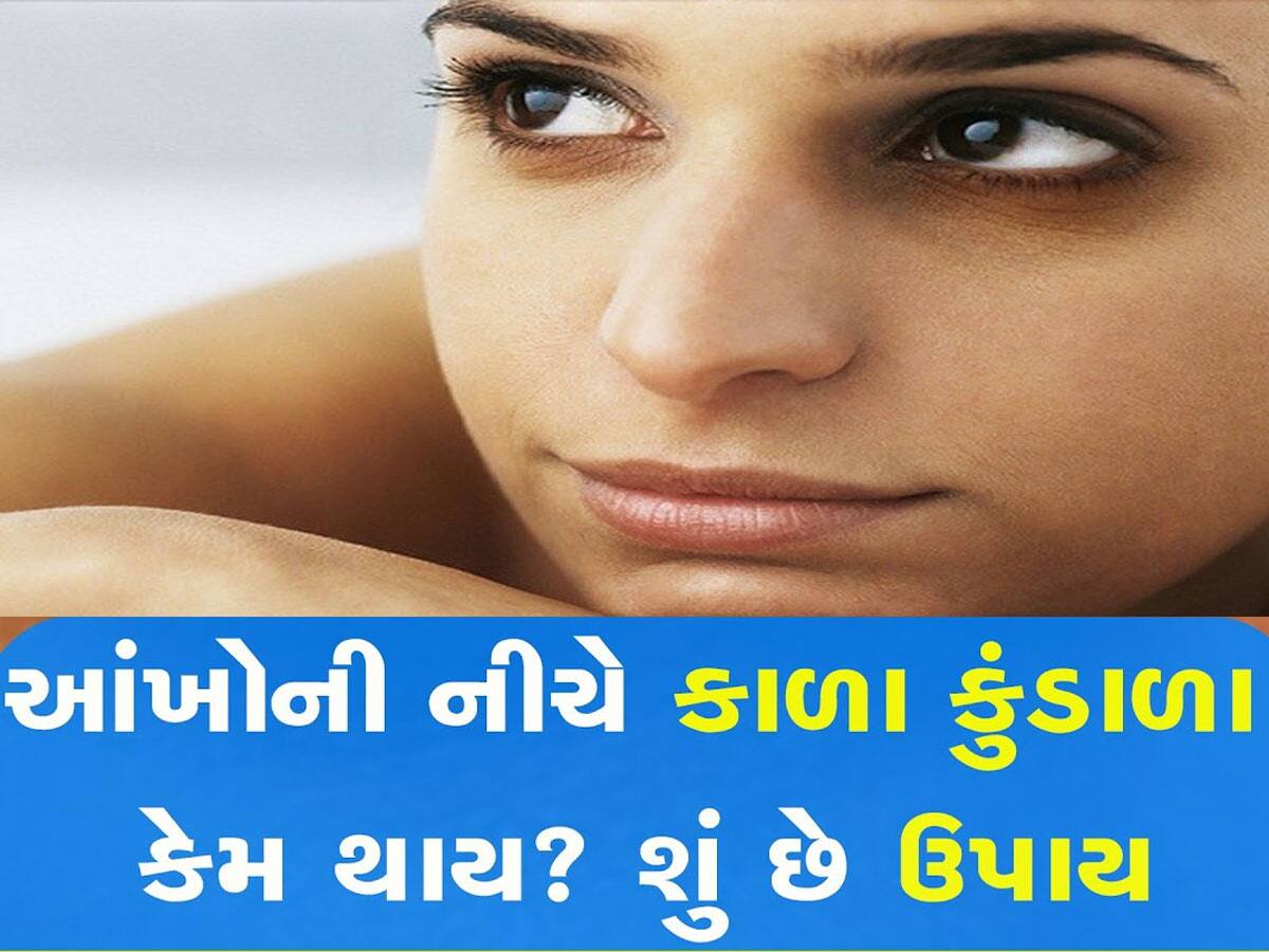 આંખો નીચે થઈ ગયા છે કાળા કુંડાળા? ફિકર નોટ, આ ટિપ્સથી થઈ જશે સમસ્યાનું સમાધાન