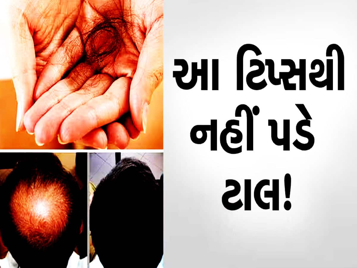 શું તમારે પણ ટાલ પાડવાની તૈયારીમાં છે? ટકલા ના થવું હોય તો આ છે રામબાણ ઉપાય