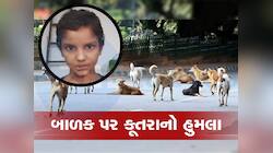 સુરતમાં કૂતરાઓનો ત્રાસ યથાવત, 9 વર્ષના બાળક પર શ્વાનનો હુમલો, લોકોમાં ભયનો માહોલ