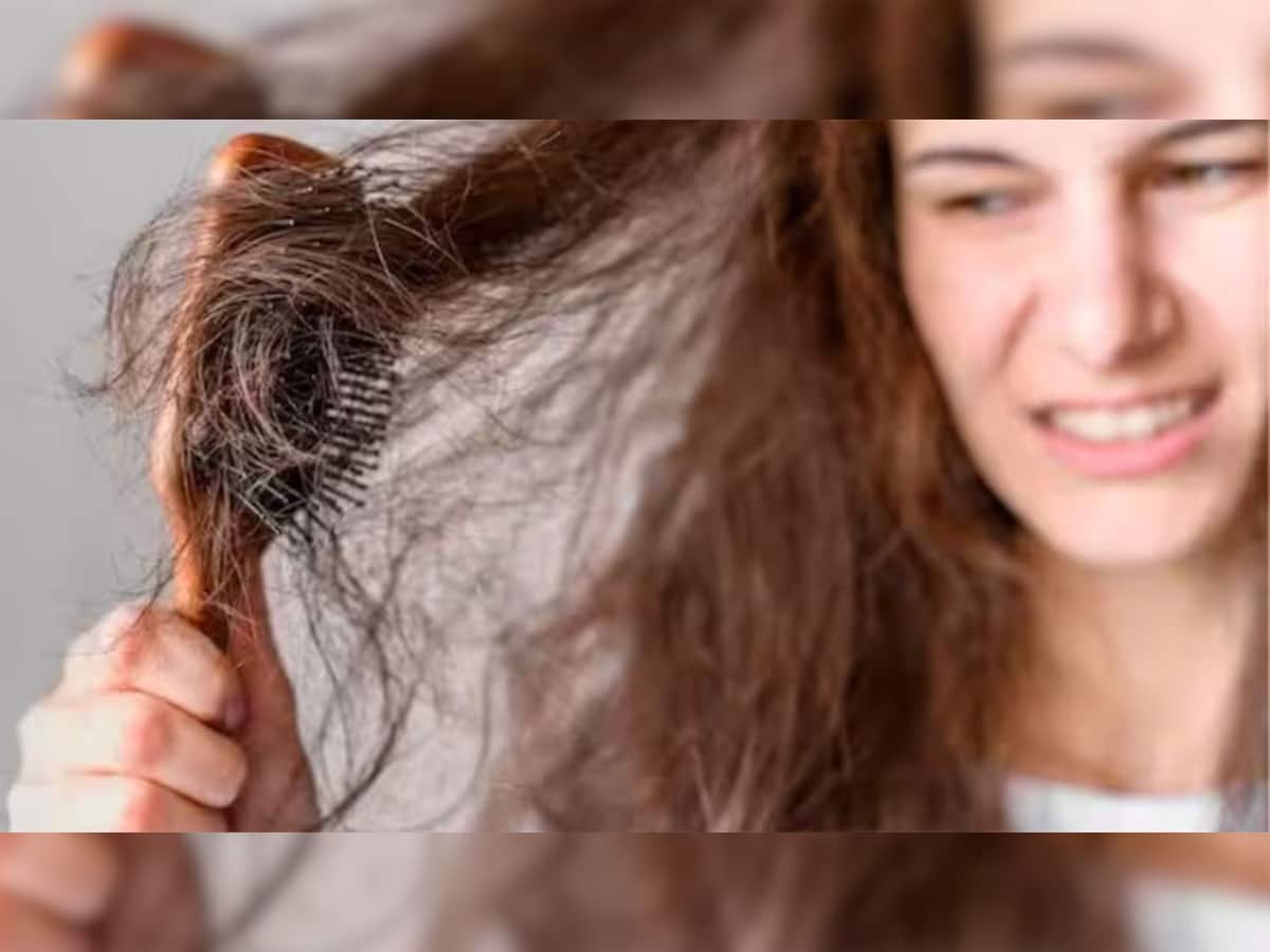 Hair Care Tips: વાળની ડ્રાયનેસથી તમે પણ છો પરેશાન? તો આ વસ્તુનો કરો ઉપયોગ, એકવારમાં જ વાળ થશે સોફ્ટ અને શાઈની