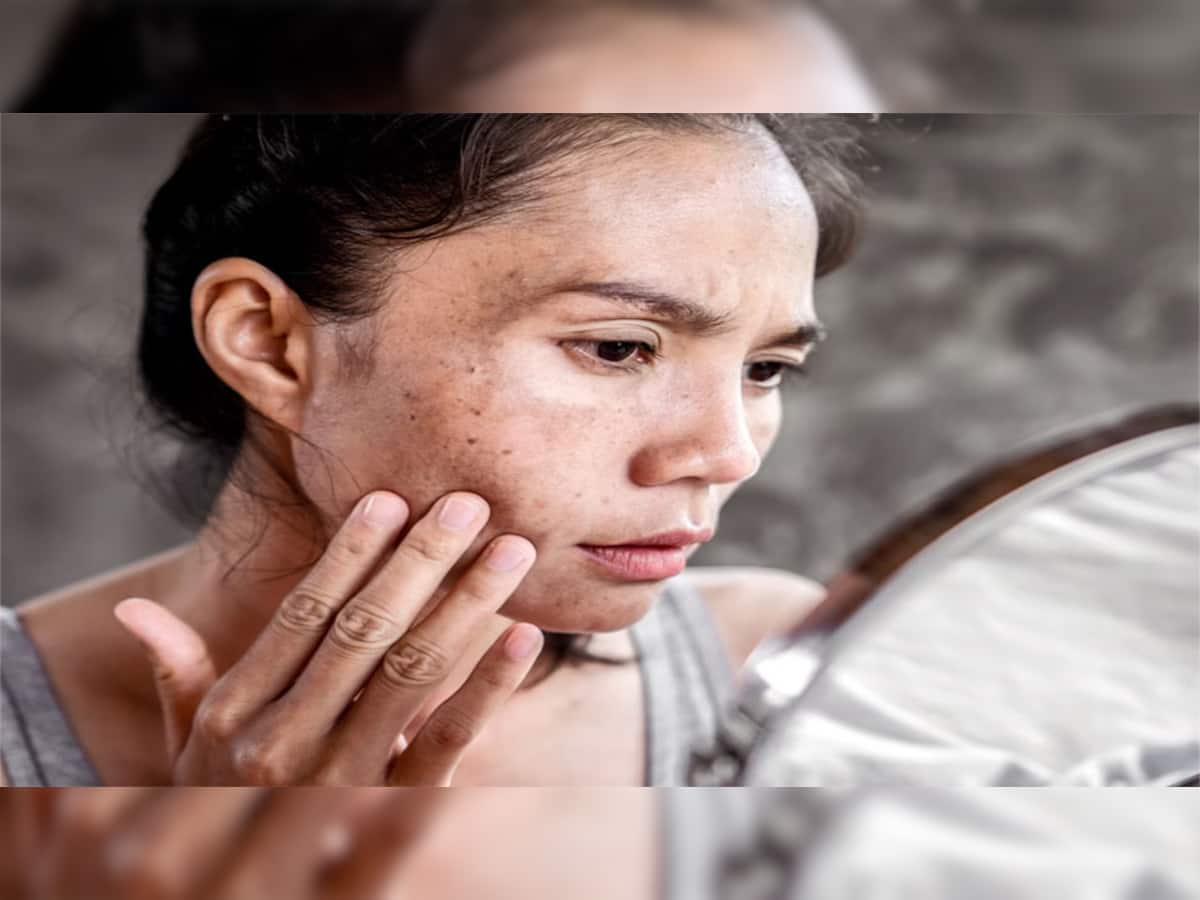 Skin Care: 4 ગંભીર બીમારીના સંકેત દેખાય છે ત્વચા પર, જોવા મળે તો સમજી લેજો તમે છો બીમાર