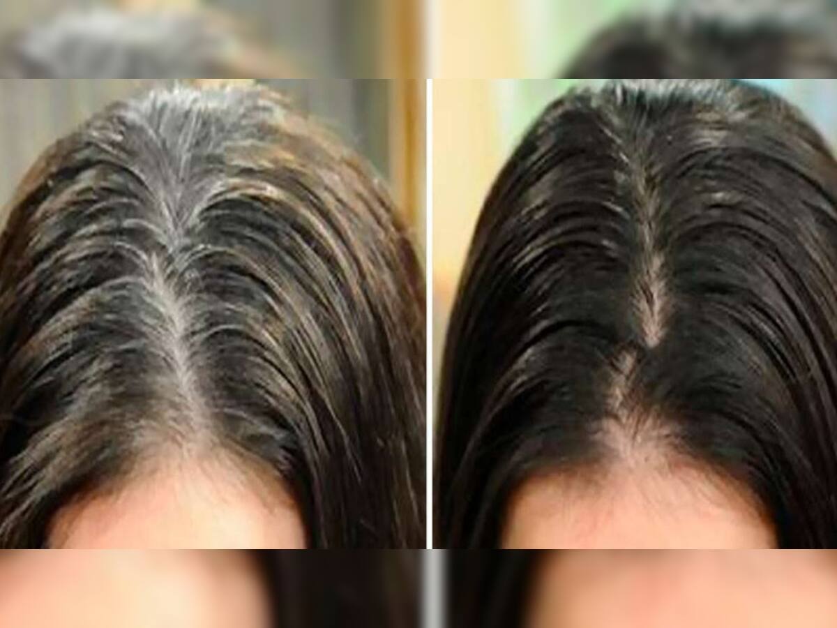 White Hair: આ વસ્તુનો ઉપયોગ કરી સફેદ વાળને મૂળમાંથી કરો કાળા, 50 વર્ષે પણ દેખાશો એકદમ યંગ
