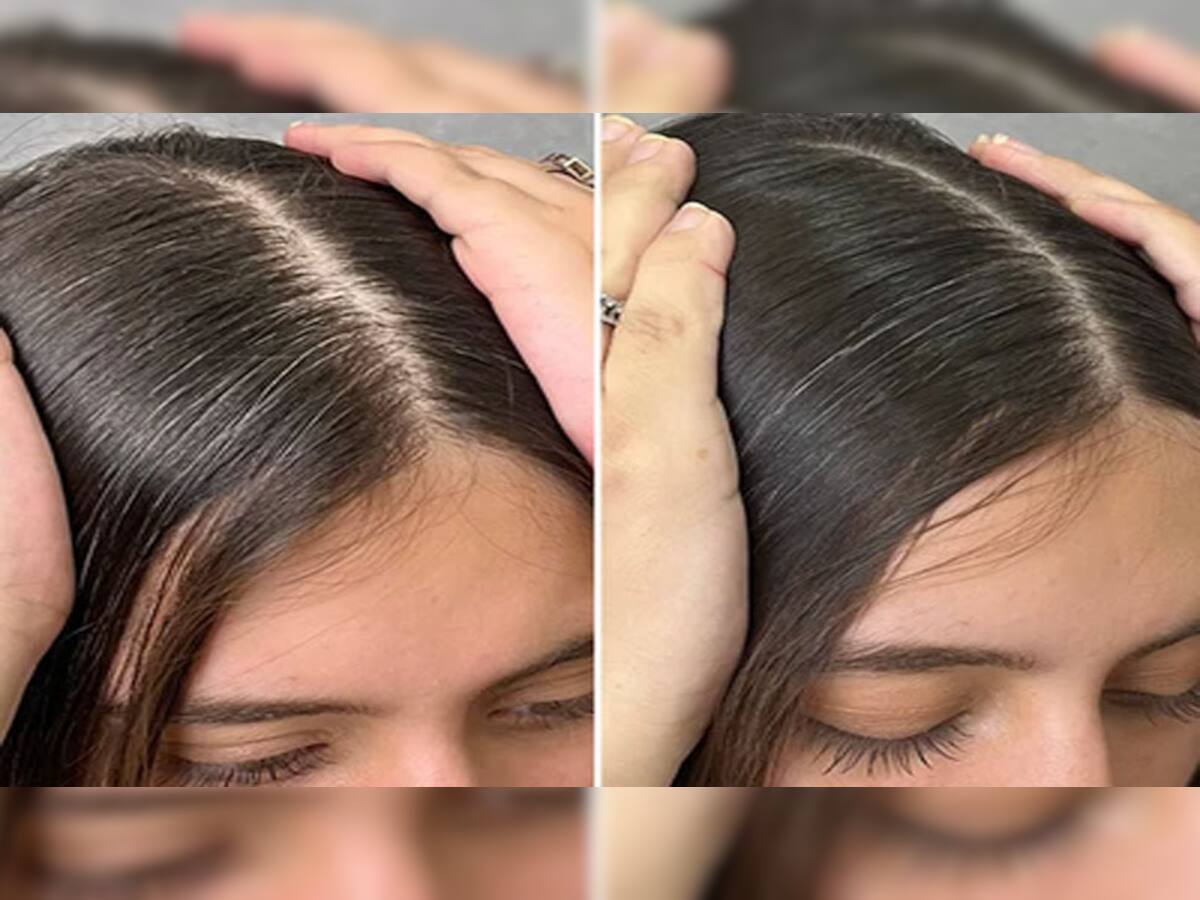 Hair Care: વિટામિનની ખામીથી પાતળા થયેલા વાળનો ગ્રોથ વધારવા અપનાવો આ 4 ઘરેલુ ઉપાય, 4 સપ્તાહમાં દેખાવા લાગશે હેર ગ્રોથ