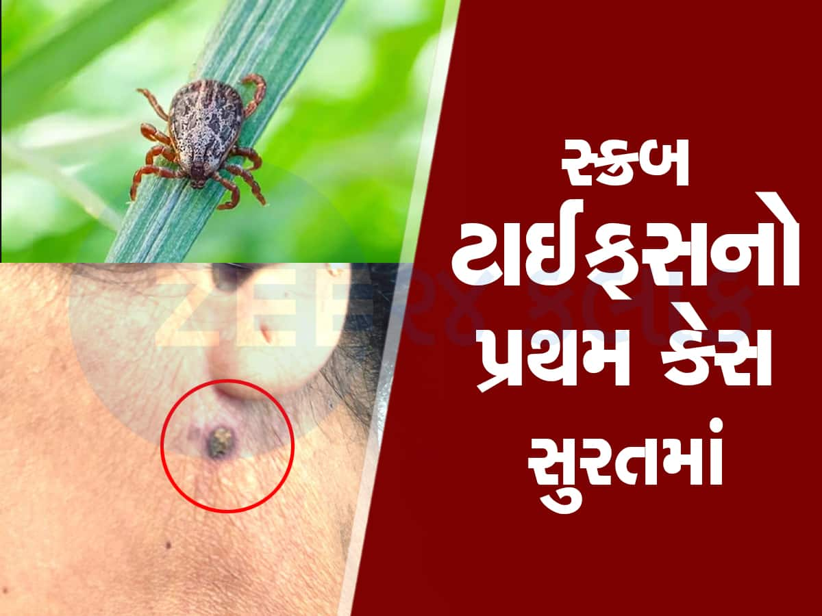 આદિવાસી મહિલાને જંગલમાં કાન પાસે જીવડું કરડ્યું, ને બેક્ટેરિયા આખા શરીરમાં ફેલાયા 