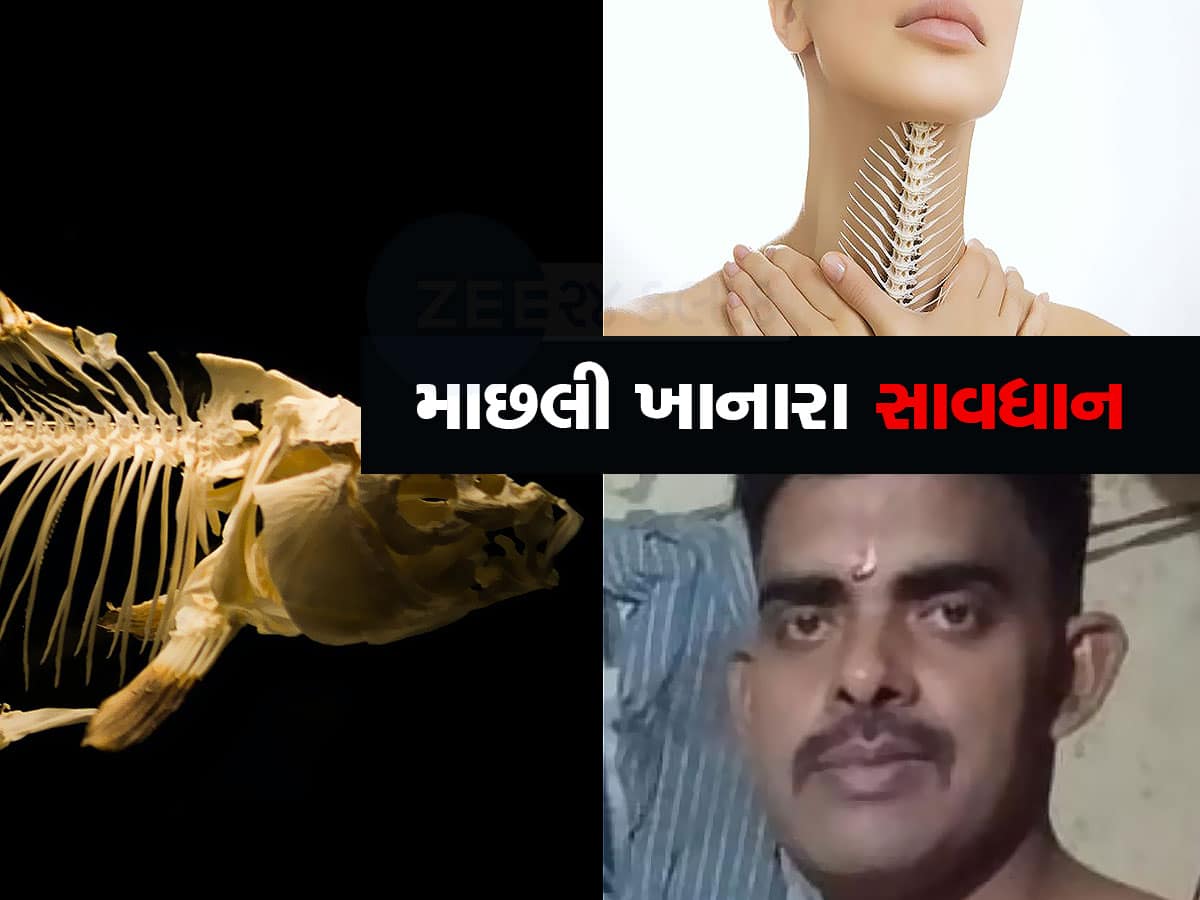 surat youth swallow fish bone in throat died before medical treatment