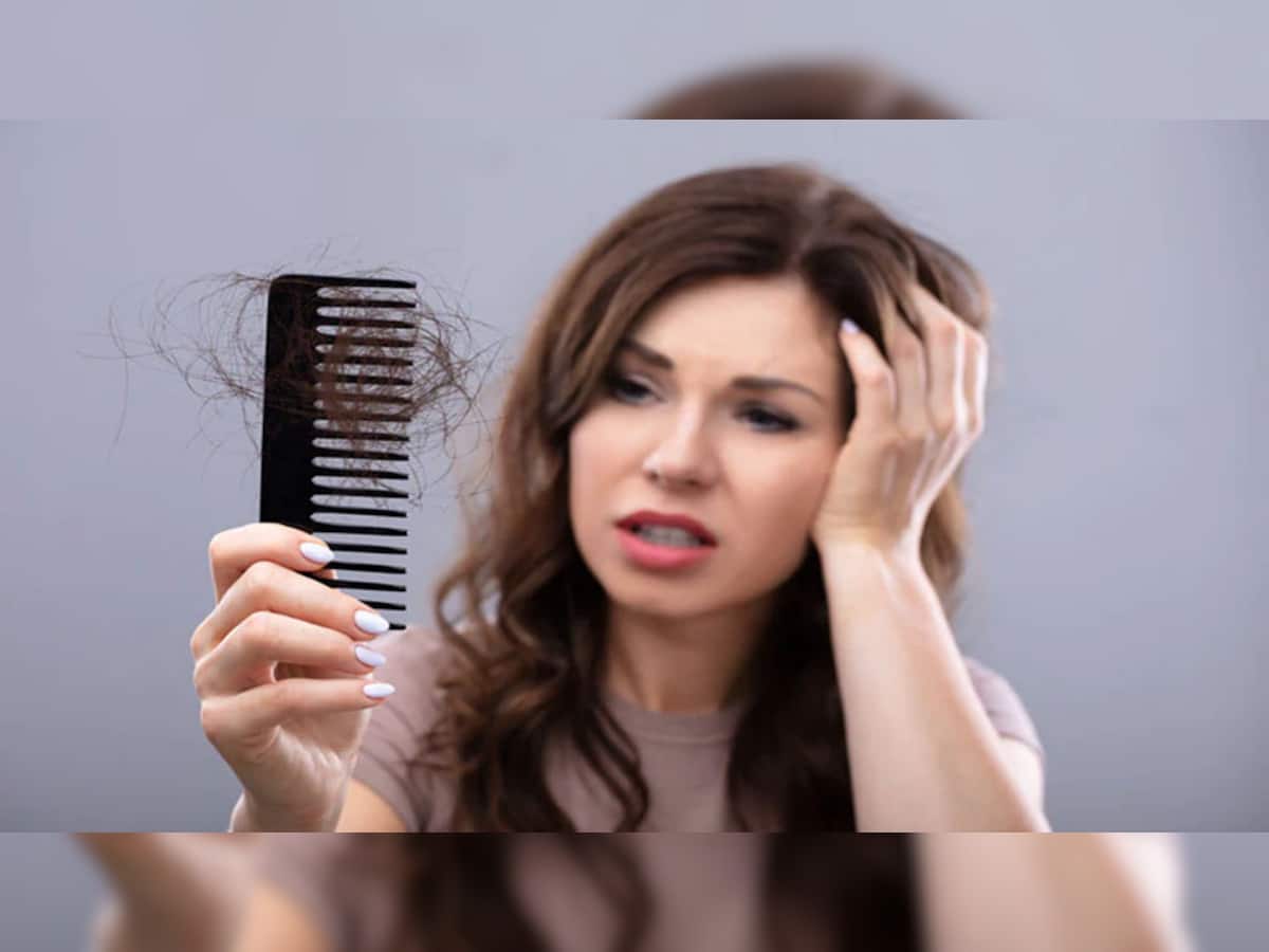 Hair Fall Remedy: ખરતા વાળની સમસ્યાનું કાયમી સમાધાન છે આ ઘરગથ્થુ ઉપાય, 15 દિવસમાં વાળ ખરતા થશે બંધ