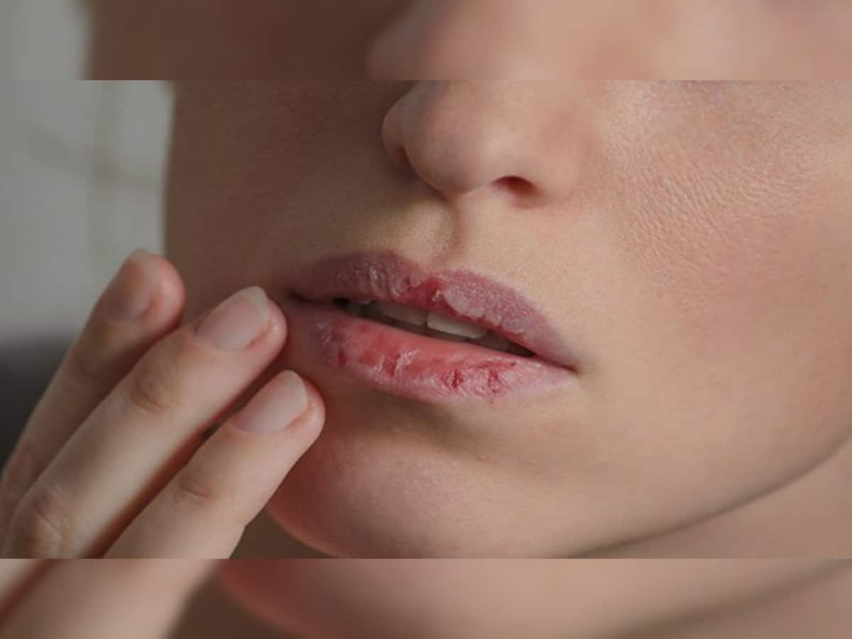 Lips Care: શિયાળામાં થતી ડ્રાય લિપ્સની સમસ્યાથી મુક્તિ મેળવવા અપનાવો આ ઘરેલુ ઉપાય