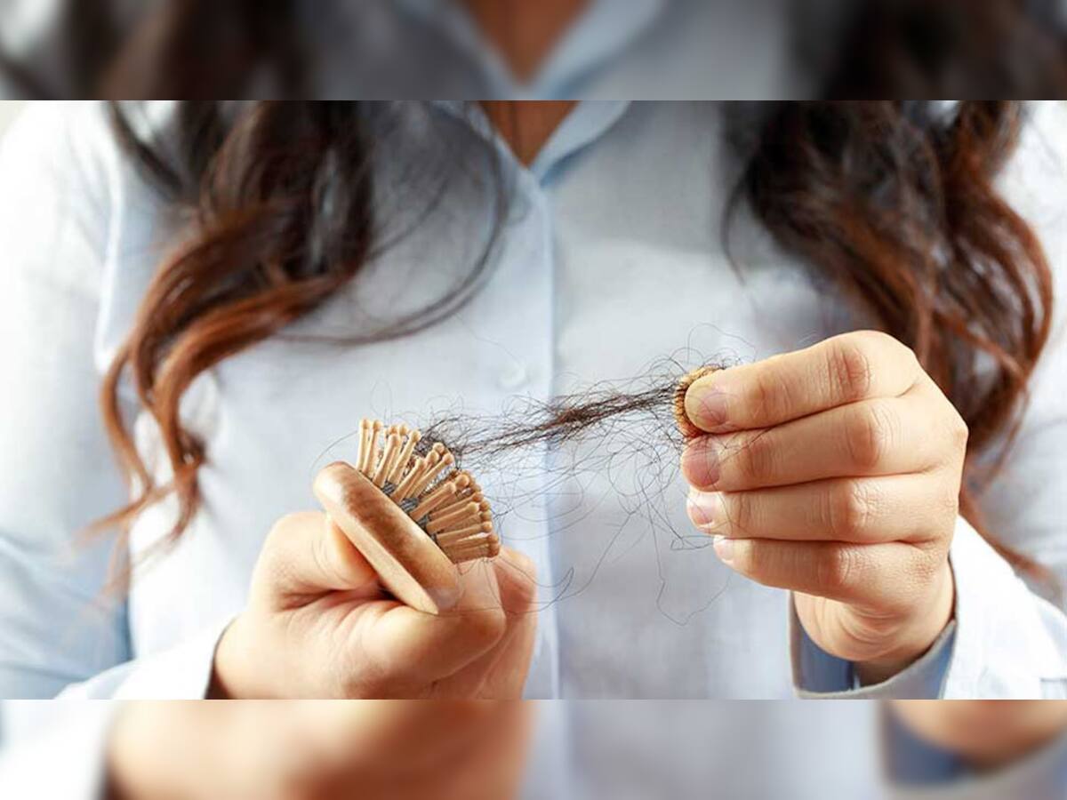 Hair Fall: કાંસકામાં રોજ દેખાય છે વાળના ગુચ્છા ? તો કરો આ 5 કામ, સાત દિવસમાં જ દેખાશે જાદુઈ અસર