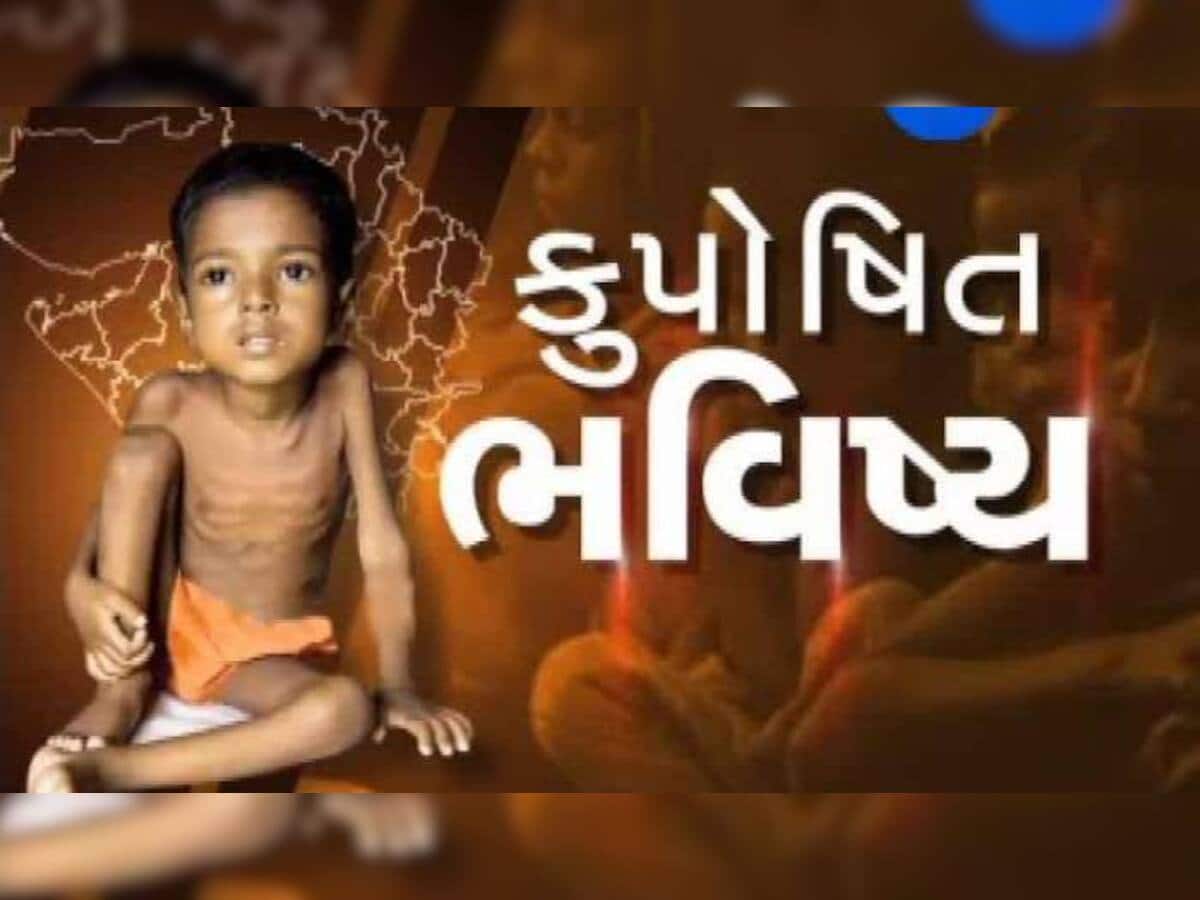 ગુજરાત સરકારે જ ખુદ કબલ્યું! વિકાસના મોડલ ગુજરાતમાં કુપોષિત બાળકોનો આંકડો ચિંતાજનક