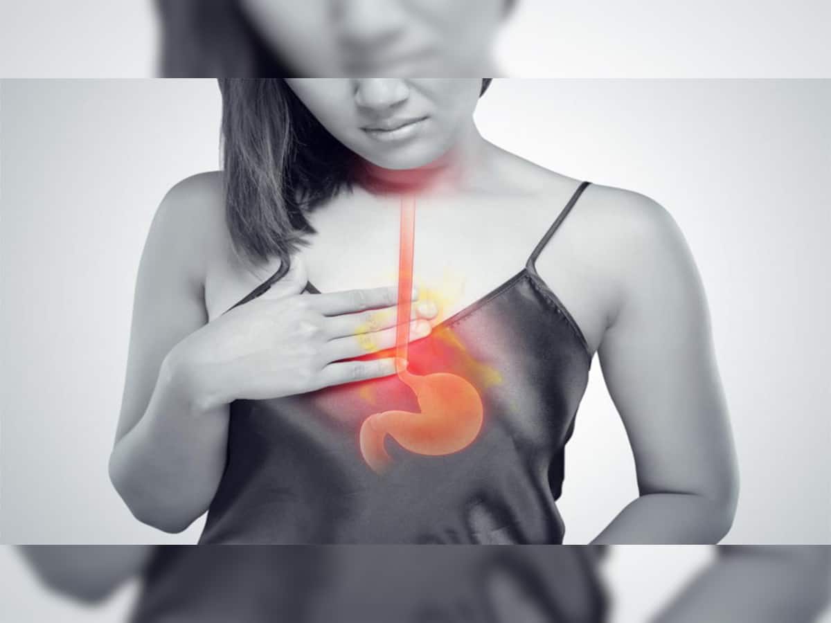 Heartburn: શું તમને પણ વારંવાર થાય છે છાતીમાં બળતરા? તો જાણો તેના કારણ અને તેનાથી મુક્તિ મેળવવાના ઉપાય