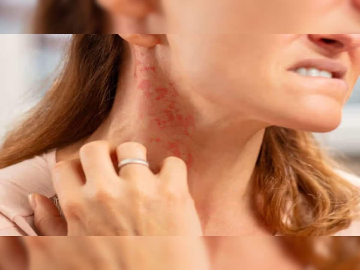 Skin Care: ત્વચાની ખંજવાળ અને એલર્જીથી મુક્તિ મેળવવા નહાવાના પાણીમાં ઉમેરો આ વસ્તુઓ