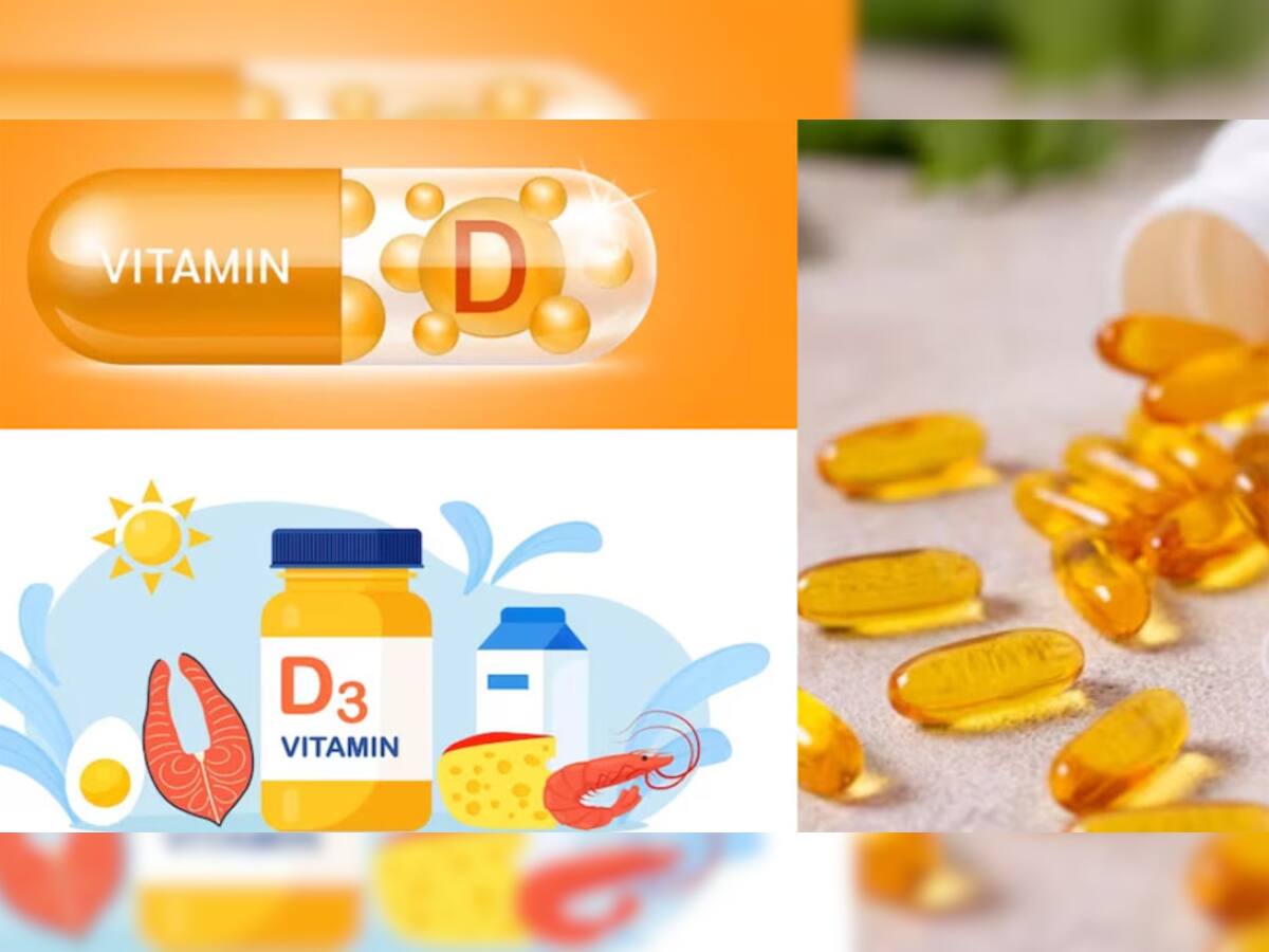  Vitamin D ની સપ્લીમેન્ટ લેતા પહેલા આ 4 વાતોને રાખજો ધ્યાનમાં, નહીં તો ઊલમાંથી ચૂલમાં પડશો