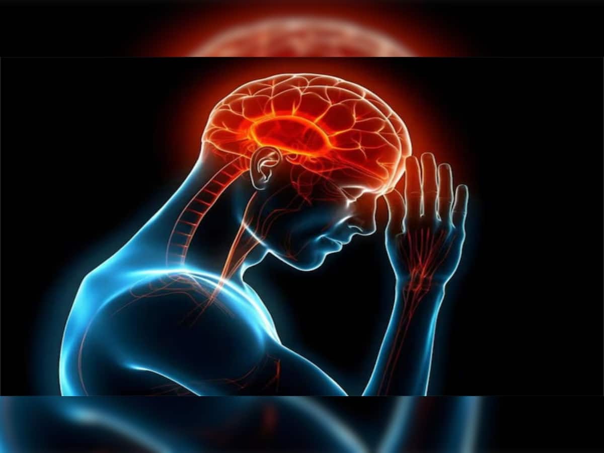 Brain hemorrhage પહેલા જોવા મળે છે આ લક્ષણો, સારવાર ન કરવાથી ફાટી શકે છે મગજની નસ