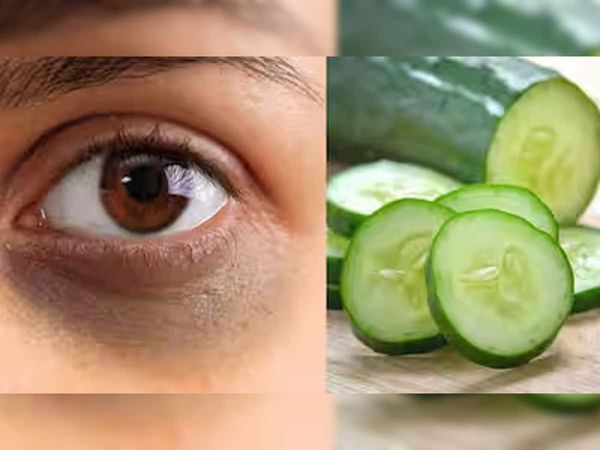 Dark Circles: કાકડી ગણતરીના દિવસોમાં દુર કરશે ડાર્ક સર્કલ્સ, 3 રીતે ઉપયોગ કરી શકો છો