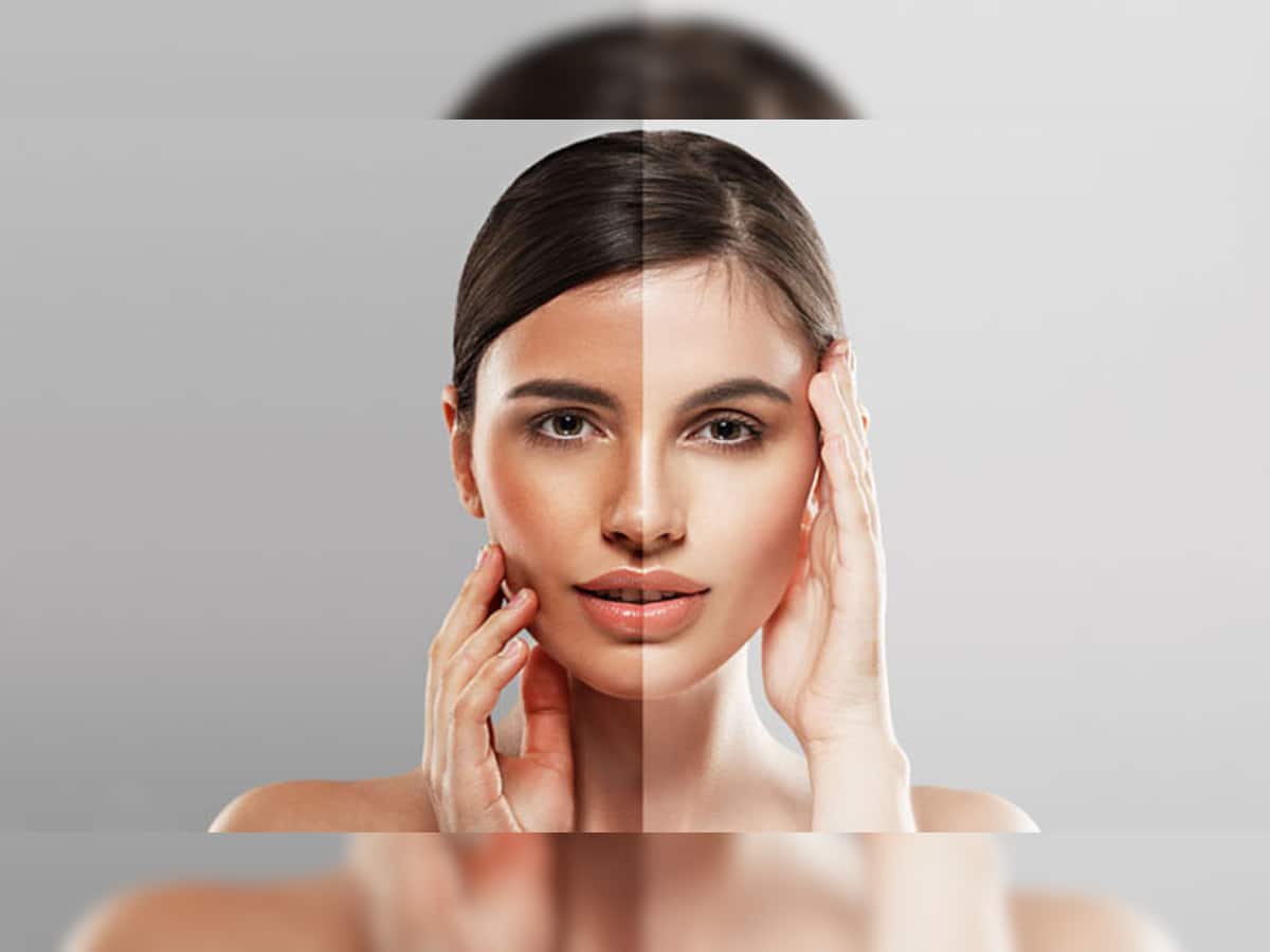 Skin Care: ટેનિંગ દૂર કરવા આ 3 રીતે દહીંનો કરો ઉપયોગ, 10 મિનિટમાં ચહેરો ચમકી જશે