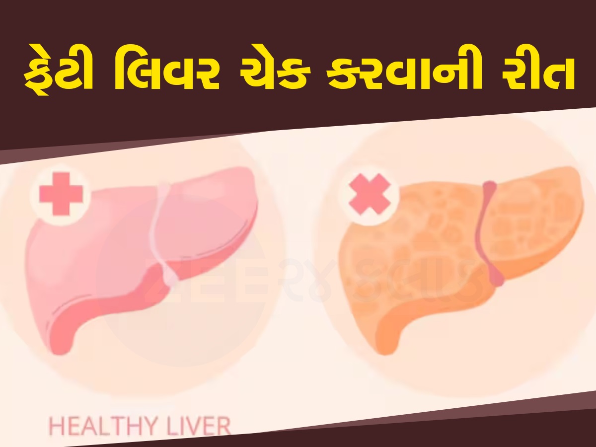 World Liver Day 2024: લિવર ફેટી છે કે નહીં, તમારા કોલરની સાઇઝથી પડી જશે ખબર, આ રીતે કરો ચેક