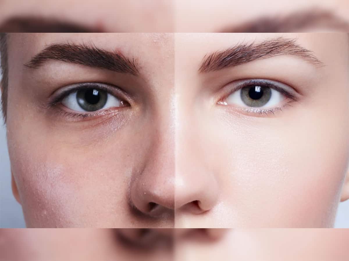 Glowing Skin: ચહેરા પર મોંઘી ક્રીમને બદલે આ 5 સસ્તી વસ્તુઓનો ઉપયોગ કરો, રાતોરાત ત્વચા પર દેખાશે ચમક
