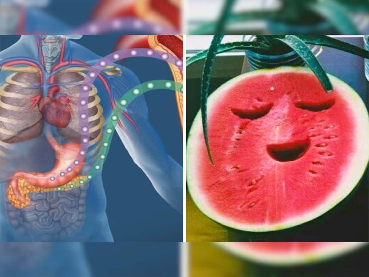Watermelon In Diabetes:ડાયાબિટીસમાં તરબૂચ ખાવાથી નુકસાન ? જાણો બ્લડ શુગર પર થતી અસર વિશે