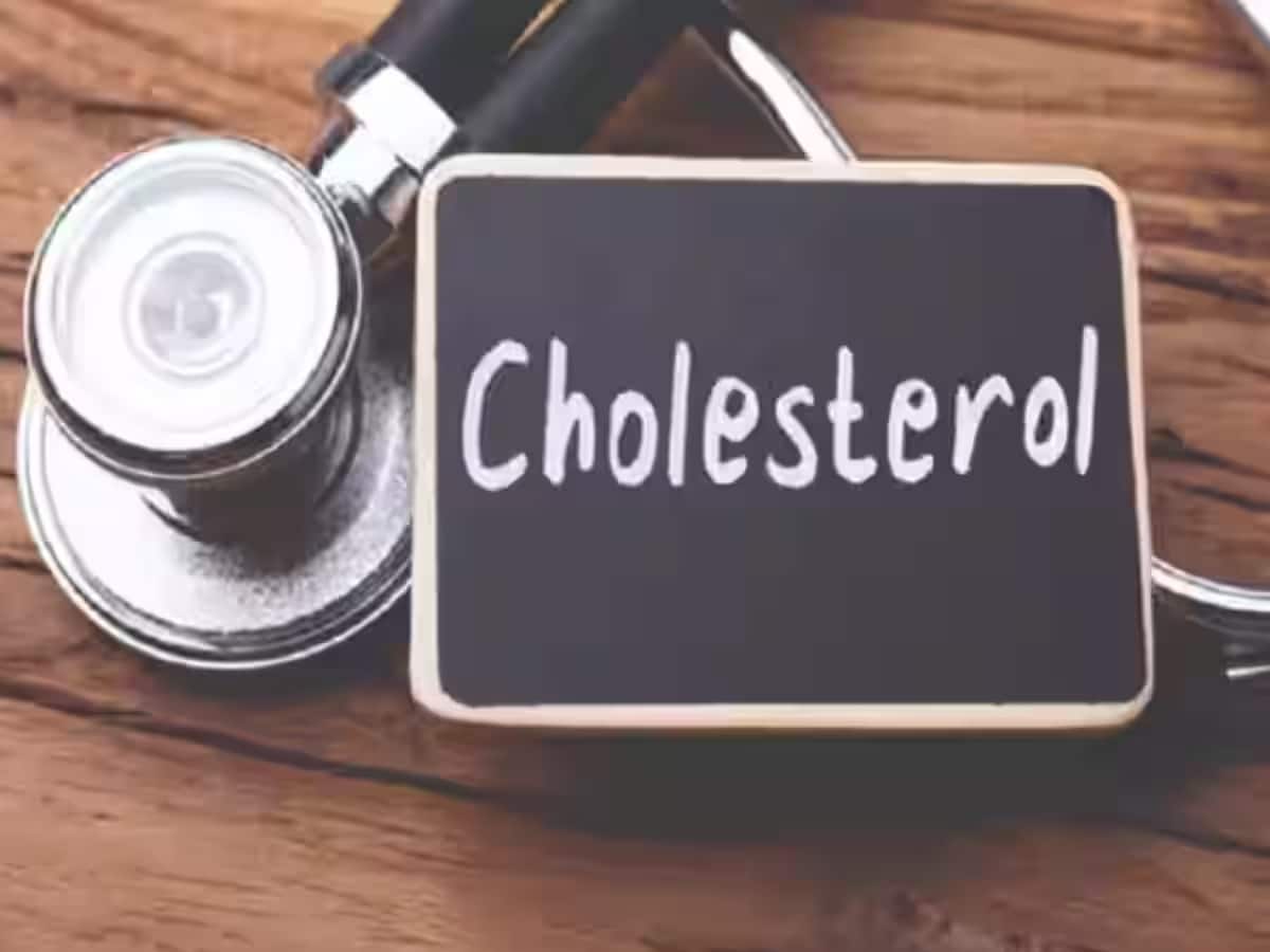 Cholesterol ઘટાડવા માટે કરો આ 5 વસ્તુનું સેવન, બીમારીઓ રહેશે દૂર