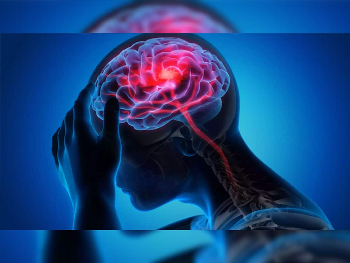 Brain Stroke Signs: મગજ સુધી ન પહોંચતું હોય લોહી ત્યારે જોવા મળે છે આ 5 લક્ષણો, બ્રેન સ્ટ્રોકની હોય છે ચેતવણી