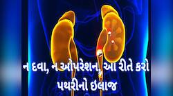 કિડનીમાં પથરી હોય તો આજથી શરૂ કરી દો આ વસ્તુઓનું સેવન, જલ્દી દૂર થશે તકલીફ