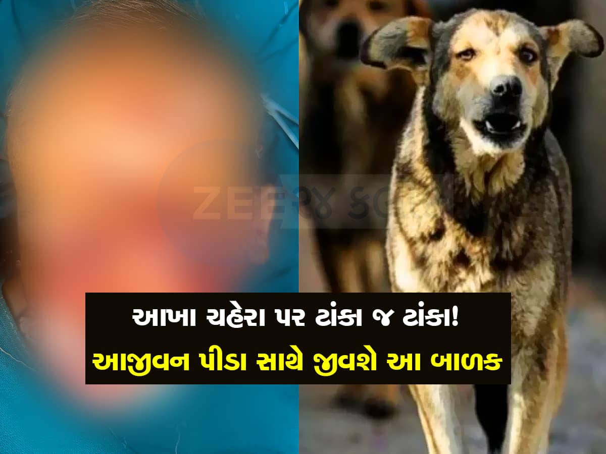 ઘોડિયામાં સૂતા બાળકને રખડતા કૂતરાએ ફાડી ખાધો, જીવ તો બચ્યો પણ 100 ટાંકા, એક આંખ કાઢવી પડી
