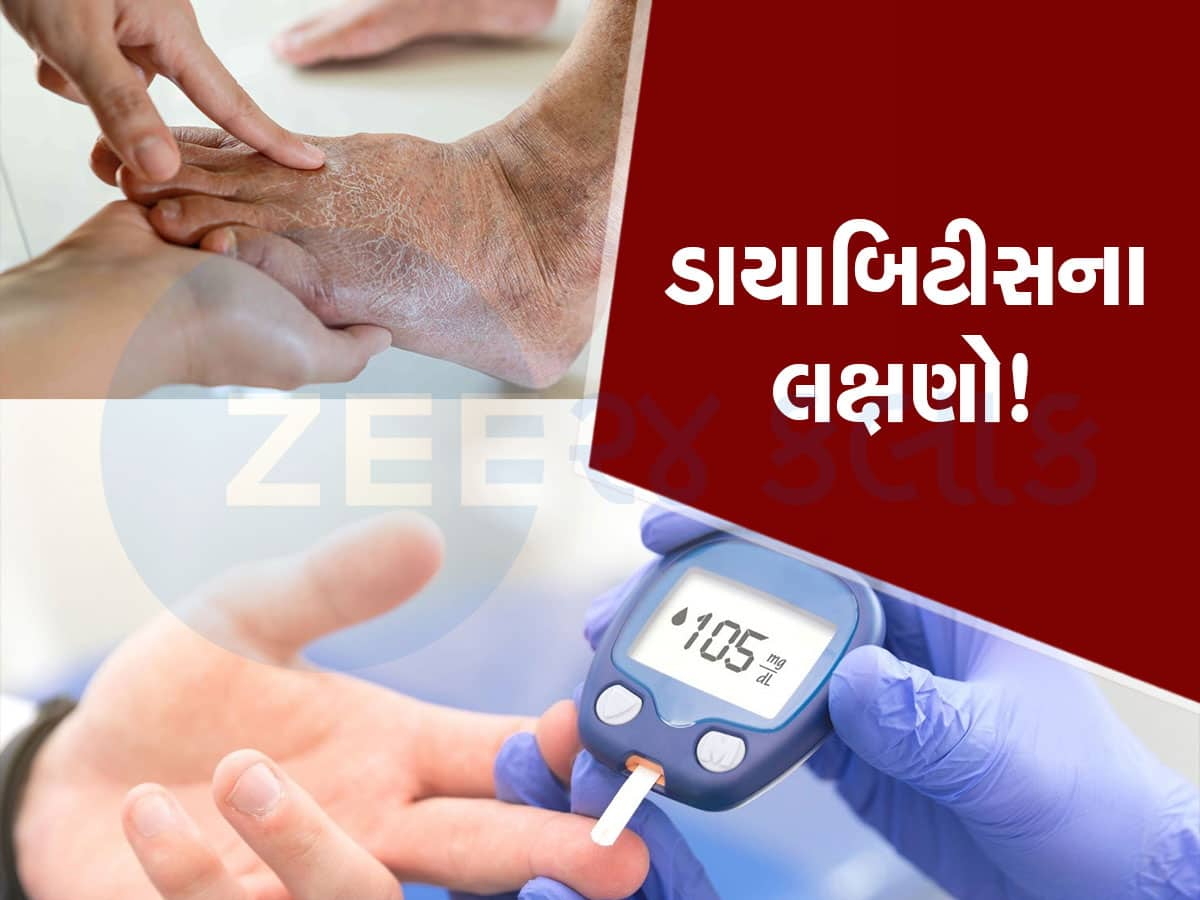 Diabetes Symptoms: પગમાં આવું જોવા મળે તો ચેતી જજો...જાણો ડાયાબિટીસના આ 5 સંકેત વિશે